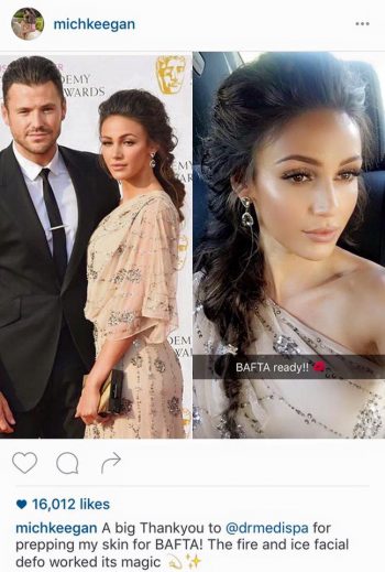 Fire Ice Michelle Keegan Baftas 2016 Dr Medispa Clinic UK