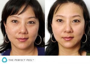 Skin Treatments Before After 21