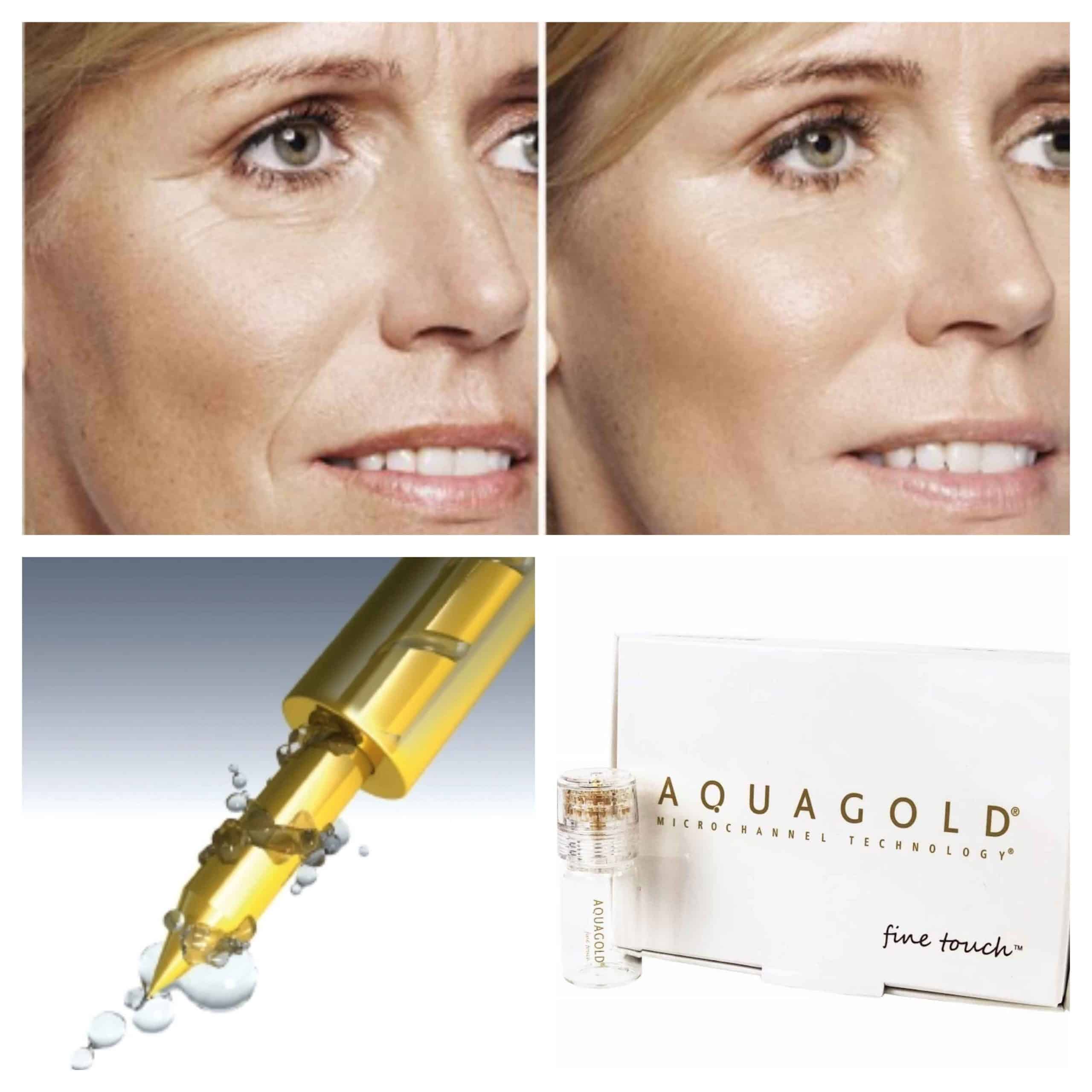 AQUAGOLD WORKSHOP Com Scaled
