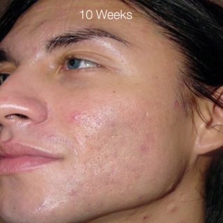 10 Weeks 1 768x768
