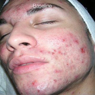 Baseline 768x768