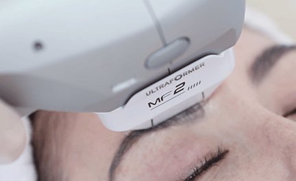 Non Surgical Face Lift